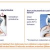BD AutoShield™ Duo turvakynäneula 0,30mm (30G) x 5mm - Image 3